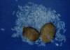 Le kyste, stade de repos protégé de ce groupe de nématodes, contient des oeufs