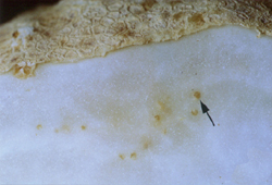 Masse d'oeufs brune (tache brune) dans le cortex d'une pomme de terre (vue d'une coupe)